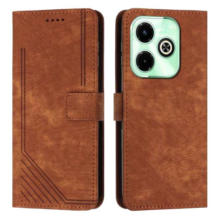 Skin Feel Stripe Pattern Leather Phone Case with Lanyard, For Infinix Note 40 4G, For Infinix Hot 40 / 40 Pro, For Infinix Hot 40i, For Infinix Smart 8, For Infinix Zero 30 4G, For Infinix Zero 30 5G, For Infinix Hot 30 Play NFC                        ...