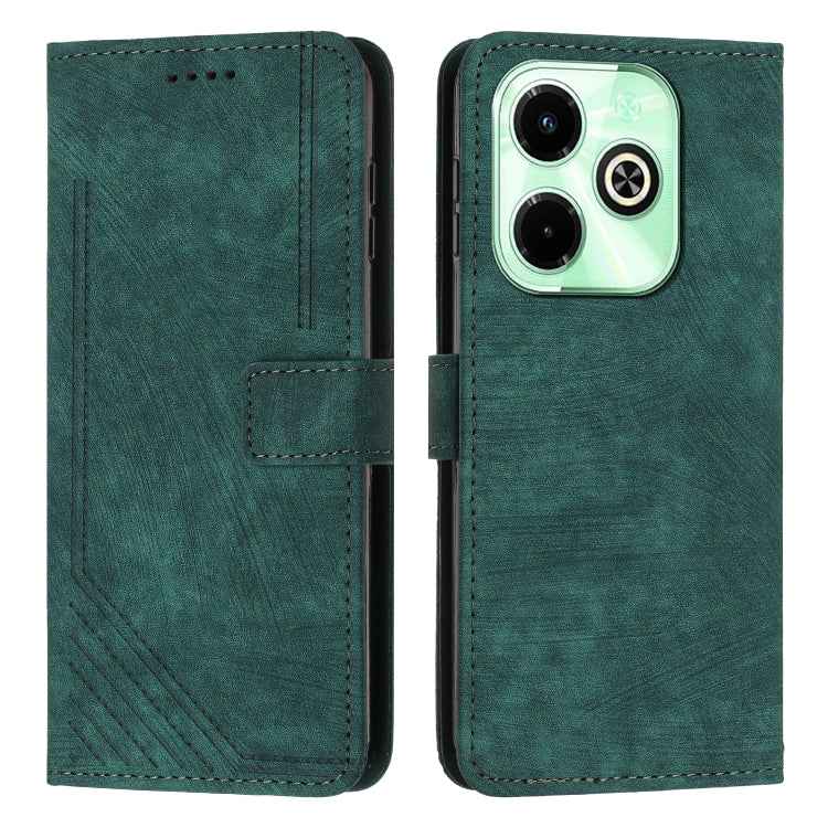 Skin Feel Stripe Pattern Leather Phone Case with Lanyard, For Infinix Note 40 4G, For Infinix Hot 40 / 40 Pro, For Infinix Hot 40i, For Infinix Smart 8, For Infinix Zero 30 4G, For Infinix Zero 30 5G, For Infinix Hot 30 Play NFC                        ...