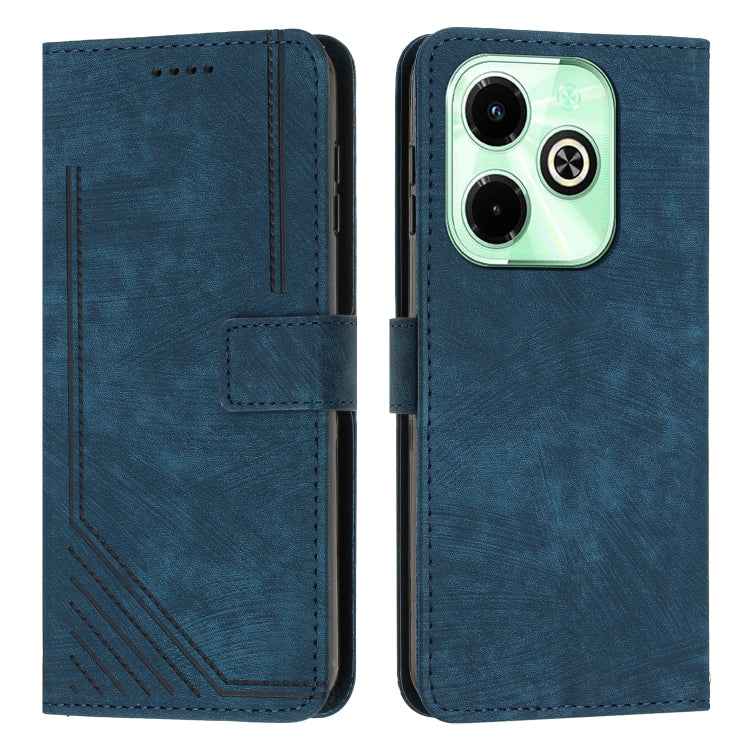 Skin Feel Stripe Pattern Leather Phone Case with Lanyard, For Infinix Note 40 4G, For Infinix Hot 40 / 40 Pro, For Infinix Hot 40i, For Infinix Smart 8, For Infinix Zero 30 4G, For Infinix Zero 30 5G, For Infinix Hot 30 Play NFC                        ...