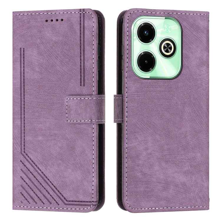 Skin Feel Stripe Pattern Leather Phone Case with Lanyard, For Infinix Note 40 4G, For Infinix Hot 40 / 40 Pro, For Infinix Hot 40i, For Infinix Smart 8, For Infinix Zero 30 4G, For Infinix Zero 30 5G, For Infinix Hot 30 Play NFC                        ...