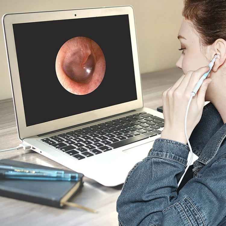 i95 3 in 1 USB Ear Scope Inspection HD 0.3MP Camera Visual Ear Spoon for OTG Android Phones & PC & MacBook, 1.75m Length Cable