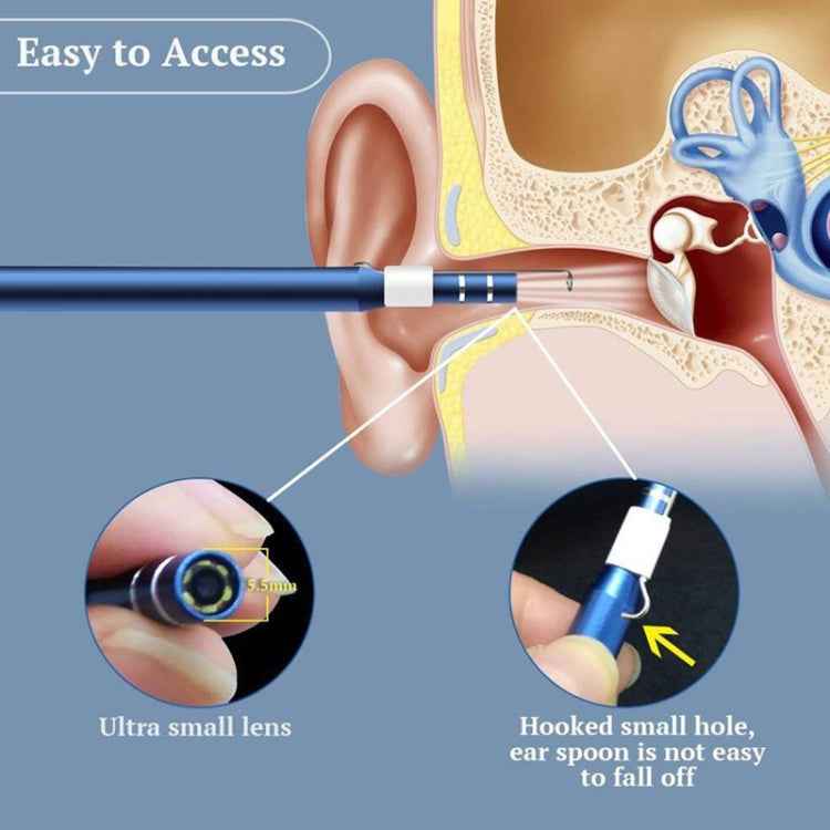i95 3 in 1 USB Ear Scope Inspection HD 0.3MP Camera Visual Ear Spoon for OTG Android Phones & PC & MacBook, 1.75m Length Cable
